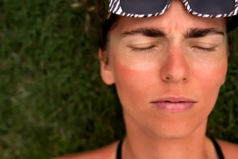 Soleil et UV : bien protéger ses yeux | Ophtalmologue Paris 8