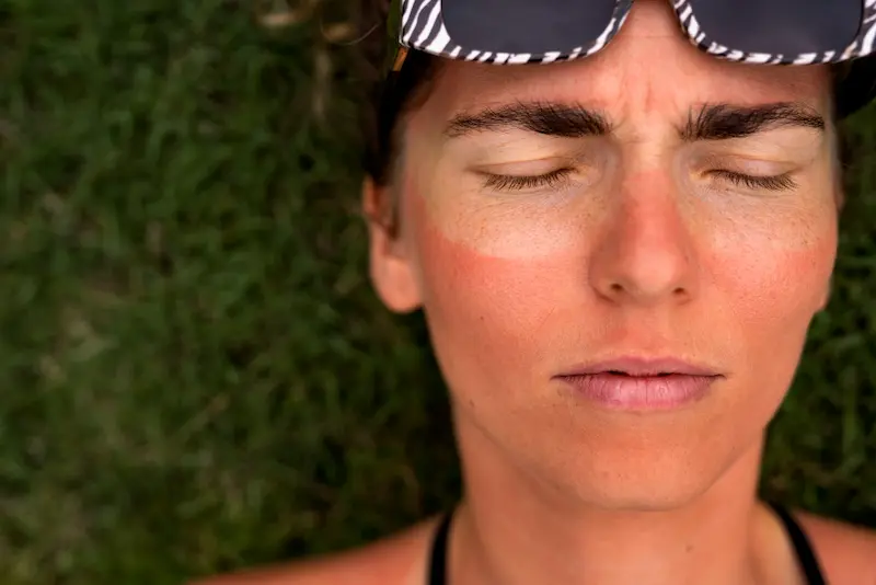 Soleil et UV : bien protéger ses yeux | Ophtalmologue Paris 8
